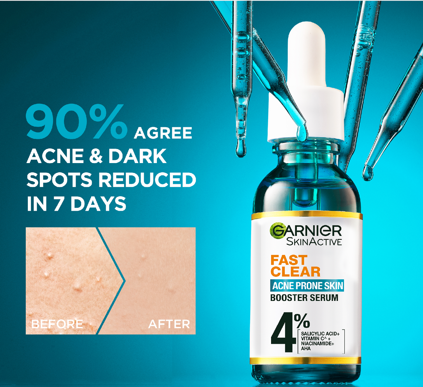 Garnier - Fast Clear Serum For Acne Prone Skin